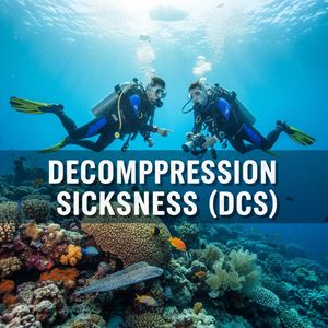 Bệnh giảm áp (Decompression Sickness (DCS)) là gì?