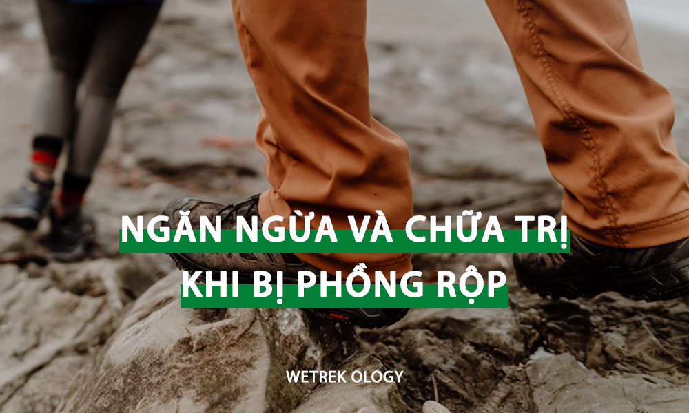 [WeTrekology] Ngăn Ngừa Và Chăm Sóc Khi Bị Phồng Rộp